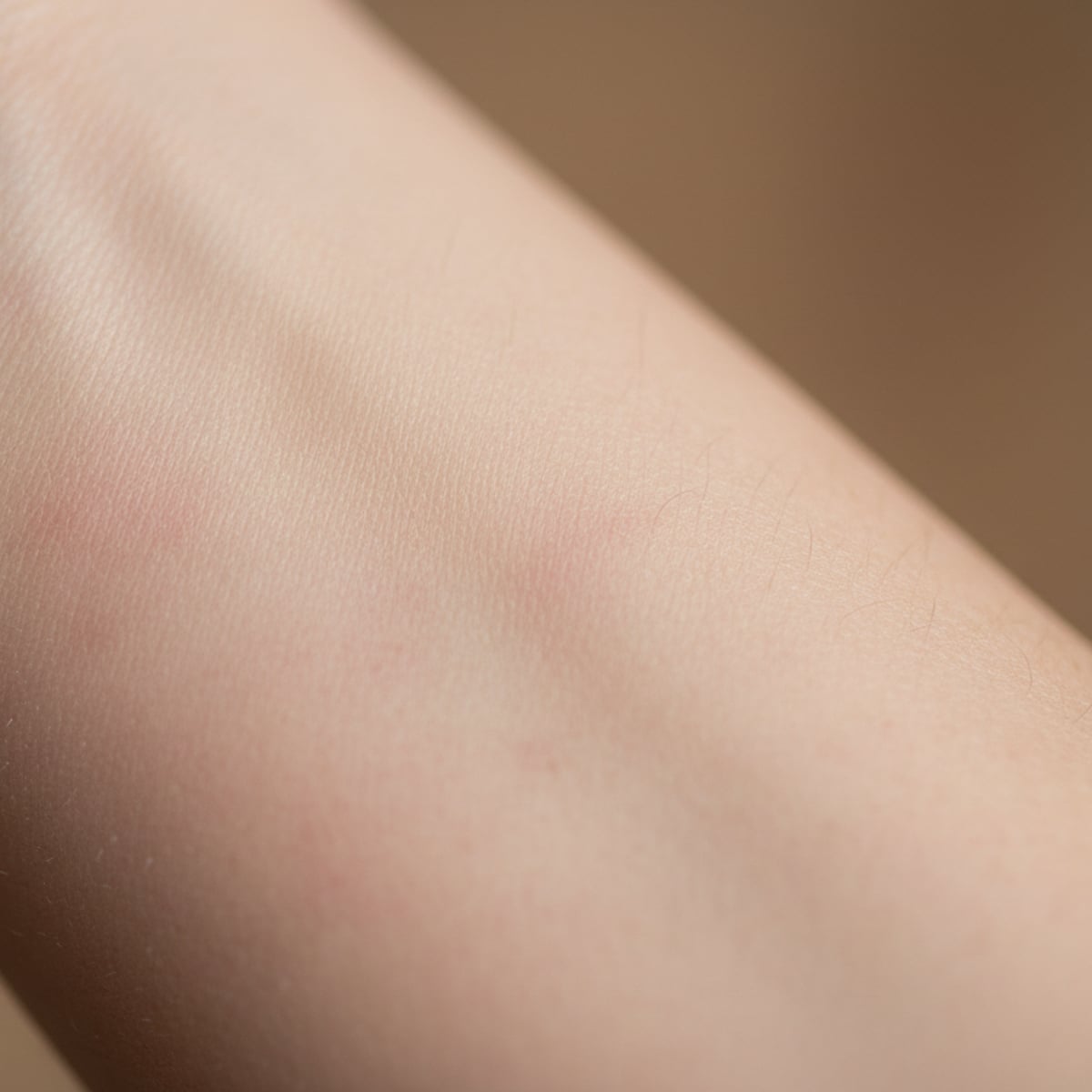 Sensitive Skin and City Water: Why It Gets Worse and How to Fix It