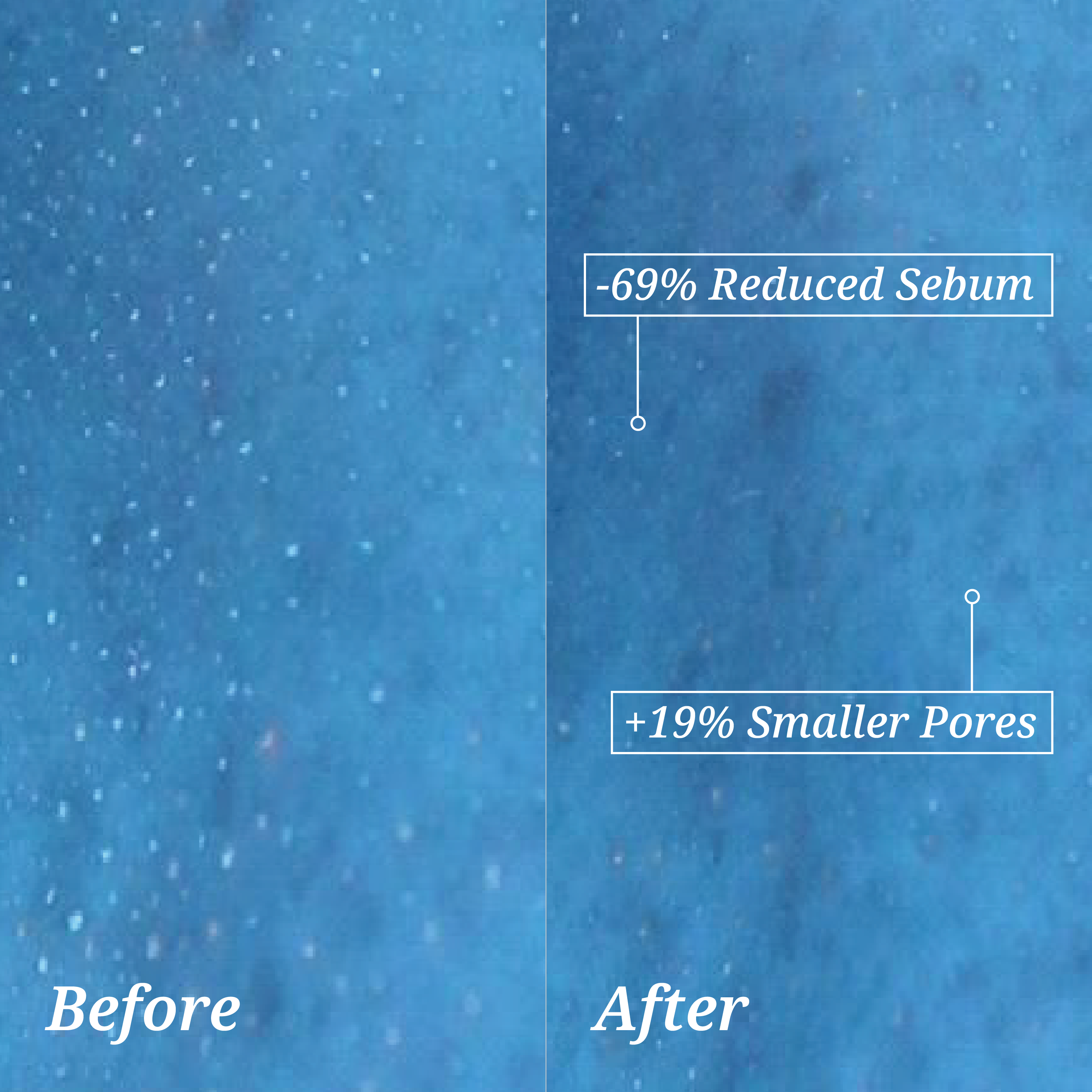 Clinically tested before-and-after image showing reduced skin sebum and smaller skin pores after 2 weeks using the Second Shower Head.