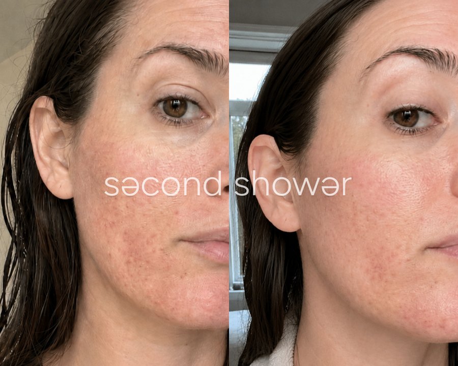 Customer photo: skin texture and tone, before and after